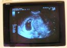 Bean's first picture